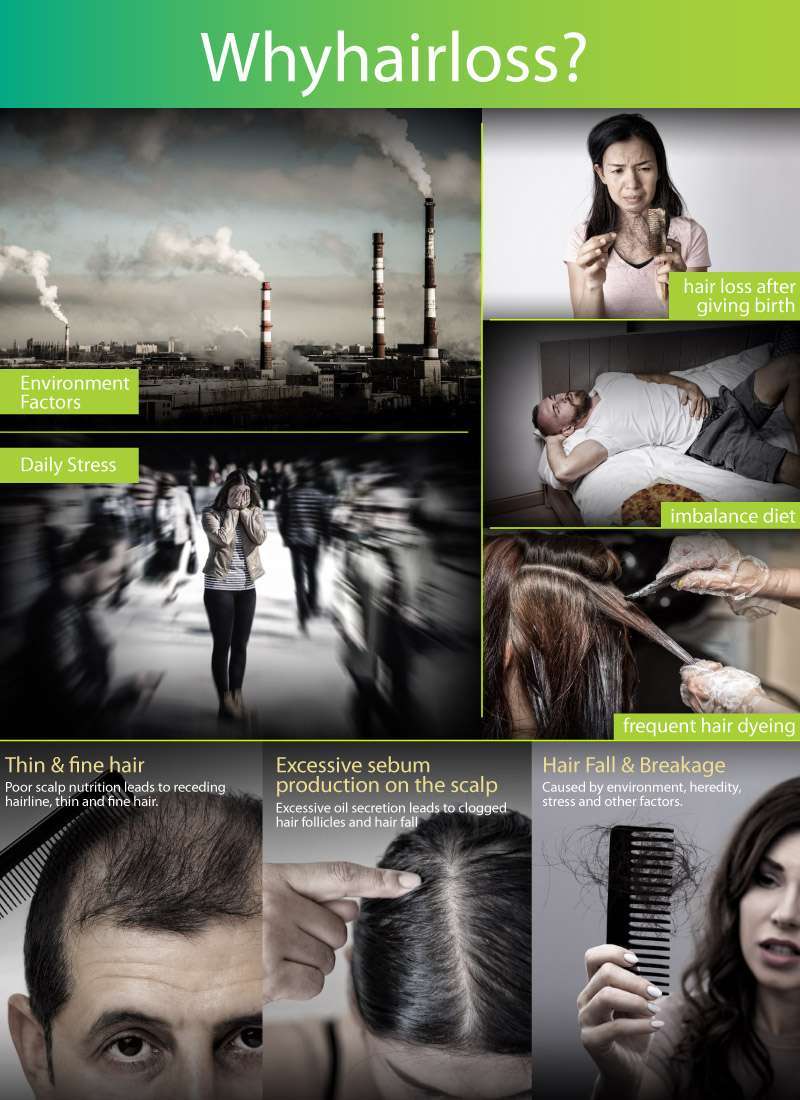 Dense & Thick Hair Set - Image 6